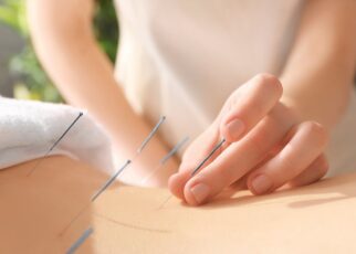 Châm cứu là gì? Cơ chế và phương pháp điều trị như thế nào?